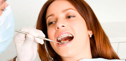 Clínica Dental Dra. Charo Díez Limpieza dental